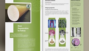 Greenbone Brochure